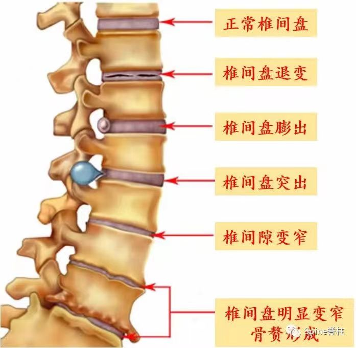 图片 11.png 图片 11.png