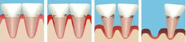 图片 3.png 图片 3.png