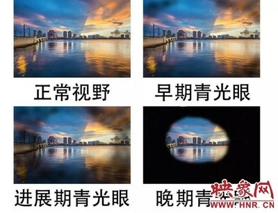 图片6.png 图片6.png