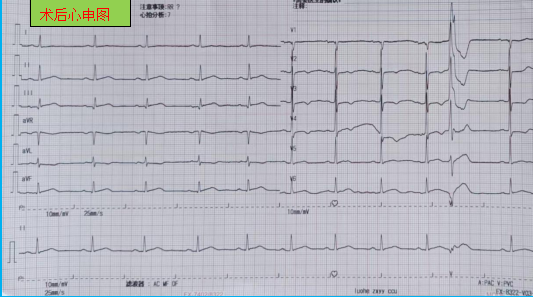 640 (10).png 640 (10).png