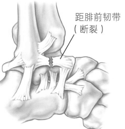 图片 2.png 图片 2.png