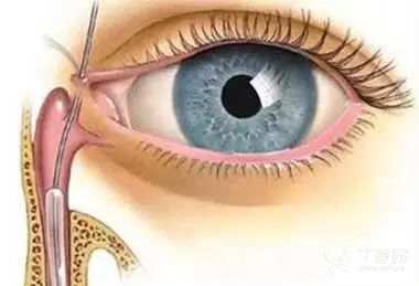 图片 5.png 图片 5.png