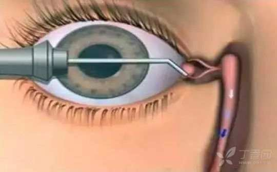 图片 4.png 图片 4.png