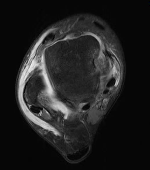 图片 5.png 图片 5.png