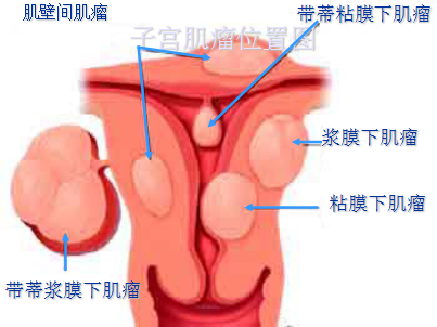 图片 1.png 图片 1.png