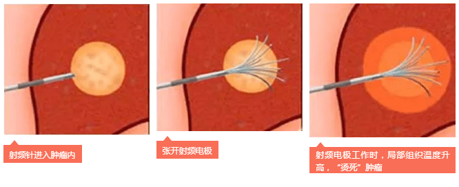 图片 5.png 图片 5.png