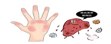 图片5.png 图片5.png