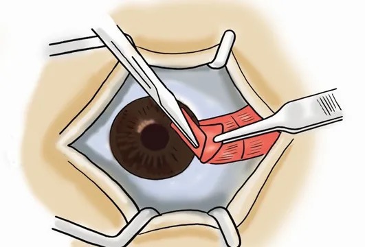 1ee15d688ed2ff9730c8ff588f06a68