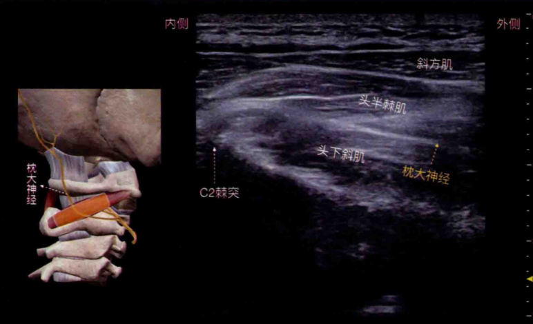 图片8.png 图片8.png