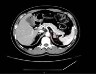 6c229b1a81d1f3ac43a9cb3df1477faa