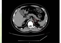 8aade990681abadcb14a4a3a87a46af6