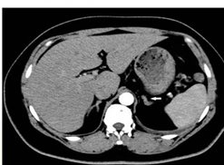 25843b4d3ac796483462f7e1148d8e0c