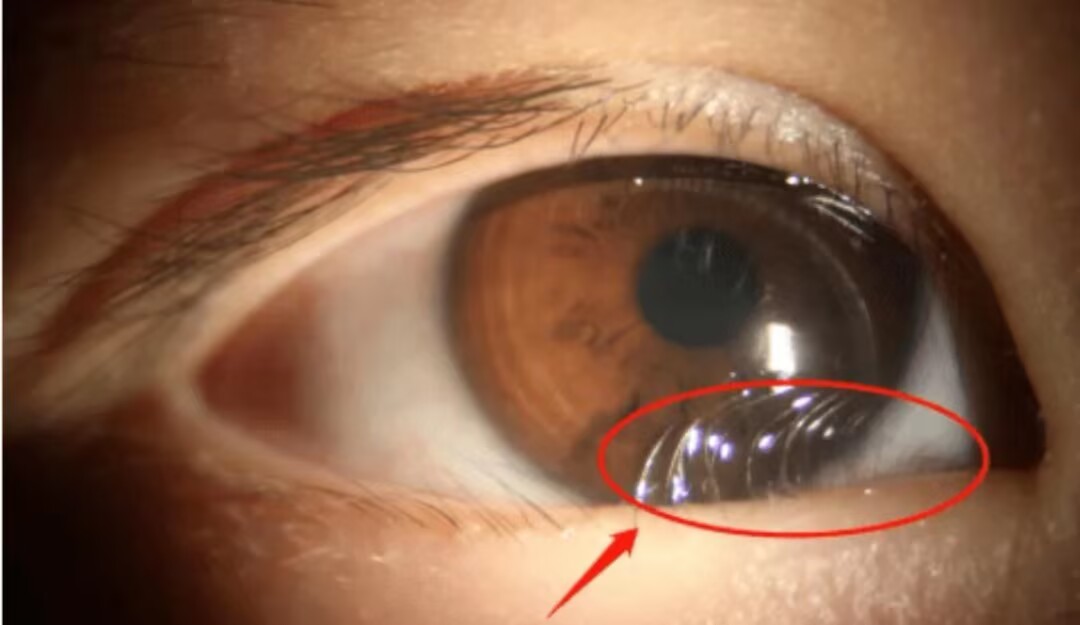 647EC83510BD9DC1C08B8EE4F8FEA54A