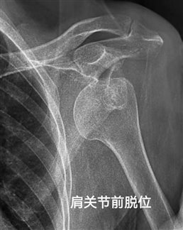 a246f53eee3195ad79b01ca60fe3d224