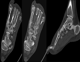 56e981a33bf610d091ca02216fcfd150