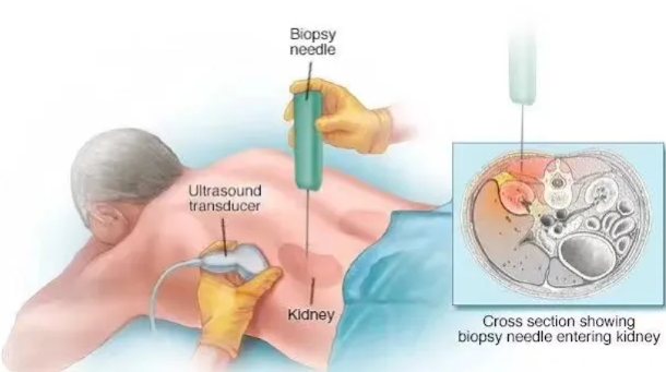 6ec9945222ae1f4105393b3829d4149d