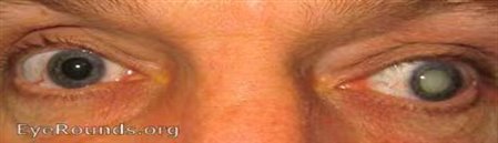 c2ba1a65547fe99c5dc4f947fdd5970e