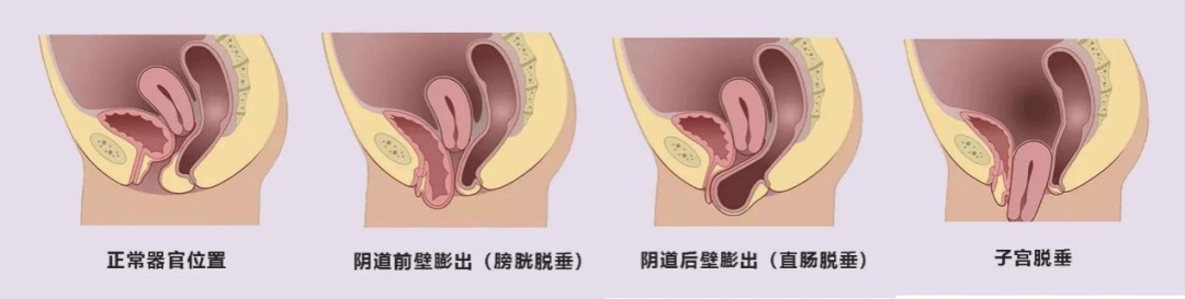 图片2_IMGC_75783851.jpg 图片2_IMGC_75783851.jpg